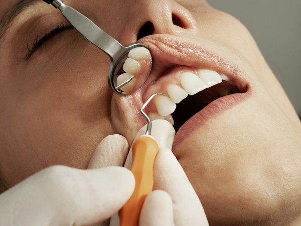 Dental Care